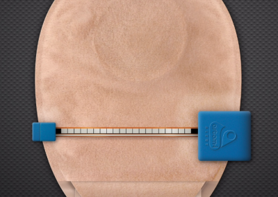 Wearable Technology in Urology | BJUI